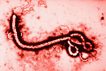 Ebola virus at 108K magnification