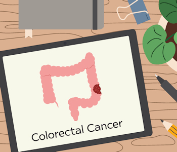 Get the Facts and Stats About Colorectal Cancer