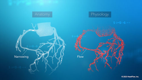 HeartFlow Anatomy